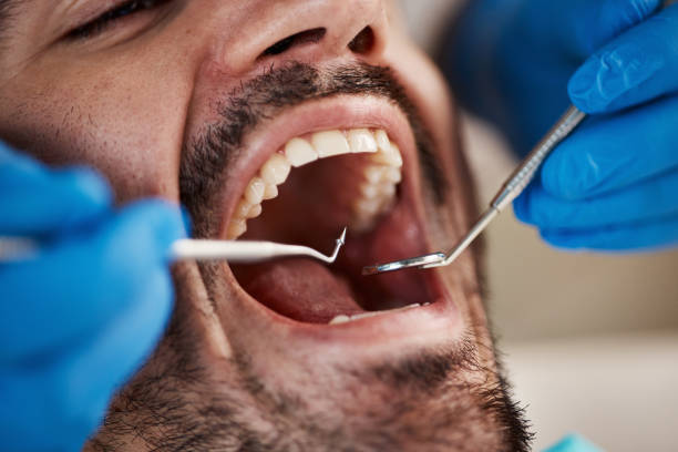 Best Emergency Treatment for Dental Infections or Abscesses in Chatham, IL