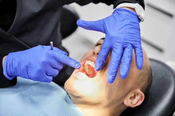 Best Emergency Tooth Extraction in Chatham, IL