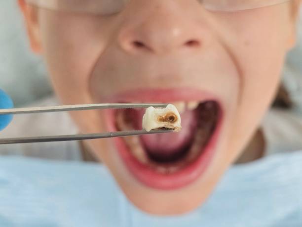 Best Emergency Denture Repair in Chatham, IL
