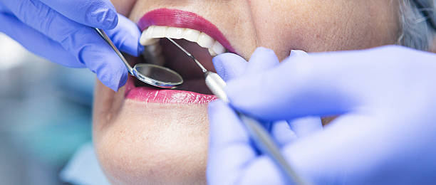 Best Emergency Dental Care for Broken or Chipped Teeth in Chatham, IL